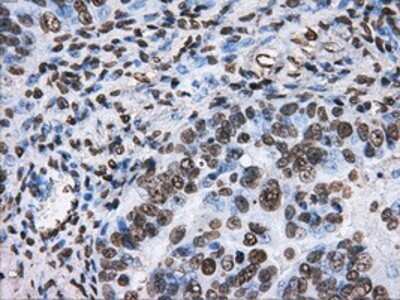 Immunohistochemistry: ATPB Antibody (OTI4E5) - Azide and BSA Free [NBP2-70224]