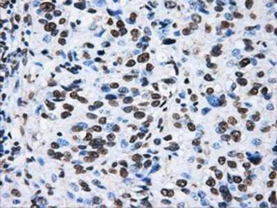 Immunohistochemistry: ATPB Antibody (OTI4E5) - Azide and BSA Free [NBP2-70224]