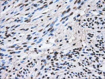 Immunohistochemistry: ATPB Antibody (OTI4E5) - Azide and BSA Free [NBP2-70224]