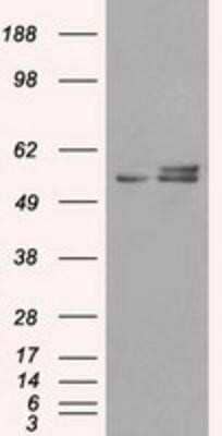 Western Blot: ATPB Antibody (OTI4E5)Azide and BSA Free [NBP2-70224]