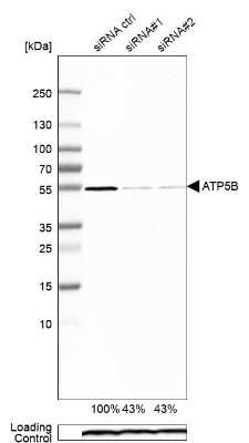 Western Blot: ATPB Antibody [NBP1-90815]