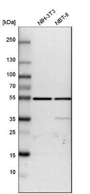 Western Blot: ATPB Antibody [NBP1-90815]