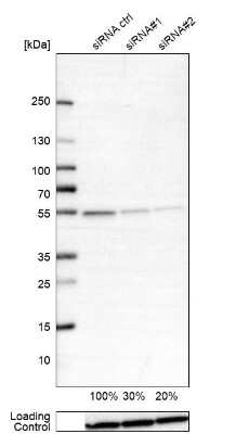 Western Blot: ATPB Antibody [NBP1-90816]