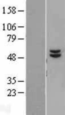 Western Blot: ATPB Overexpression Lysate [NBL1-07817]