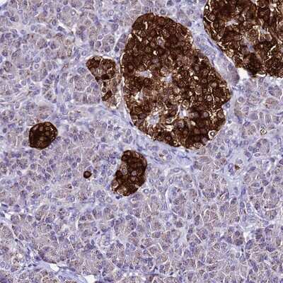 Immunohistochemistry-Paraffin: ATPBD4 Antibody [NBP1-91691]