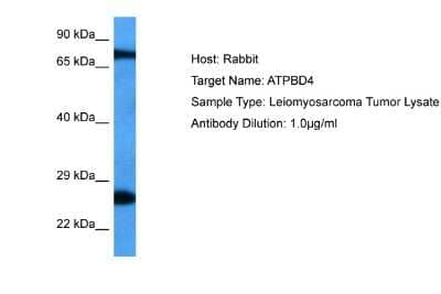 Western Blot: ATPBD4 Antibody [NBP2-84487]