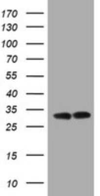 Western Blot: ATPG Antibody (OTI2H6) [NBP2-45506]