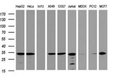 Western Blot: ATPG Antibody (OTI2H6) [NBP2-45506]