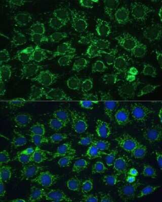 Immunocytochemistry/ Immunofluorescence: ATPG Antibody - Azide and BSA Free [NBP2-92867]
