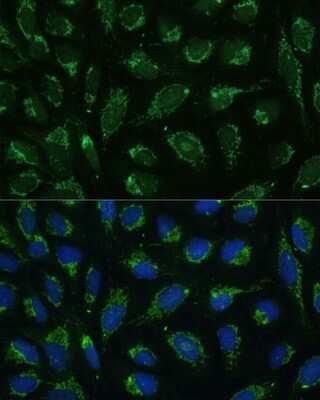 Immunocytochemistry/ Immunofluorescence: ATPG Antibody - Azide and BSA Free [NBP2-92867]