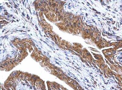 Immunohistochemistry-Paraffin: ATPG Antibody [NBP2-15525]