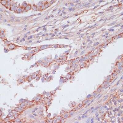 Immunohistochemistry-Paraffin: ATPG Antibody - Azide and BSA Free [NBP2-92867]