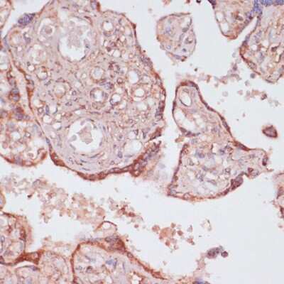 Immunohistochemistry-Paraffin: ATPG Antibody - Azide and BSA Free [NBP2-92867]