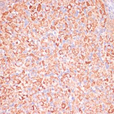 Immunohistochemistry-Paraffin: ATPG Antibody - Azide and BSA Free [NBP2-92867]