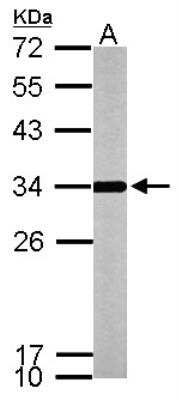 Western Blot: ATPG Antibody [NBP2-15525]