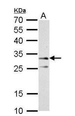 Western Blot: ATPG Antibody [NBP2-15525]