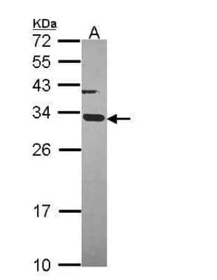 Western Blot: ATPG Antibody [NBP2-15525]