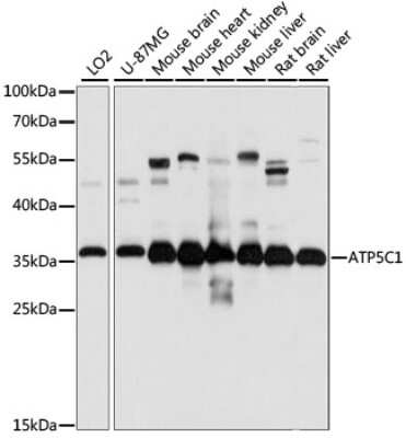 Western Blot: ATPG AntibodyAzide and BSA Free [NBP2-92867]