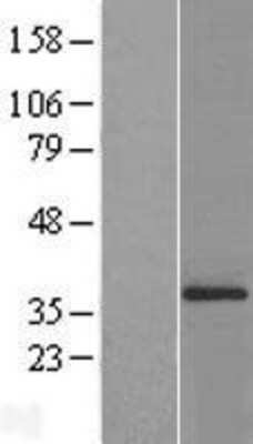 Western Blot: ATPG Overexpression Lysate [NBL1-07818]