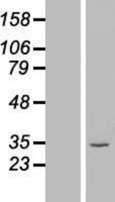 Western Blot: ATPG Overexpression Lysate [NBL1-07819]