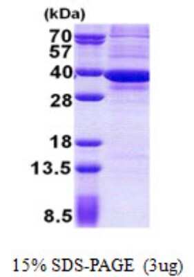 SDS-PAGE: Recombinant Human ATPG His Protein [NBP2-22699]