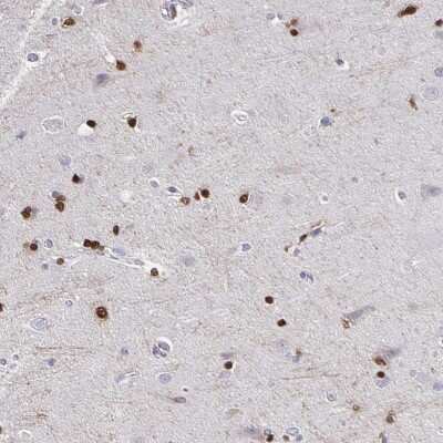 Immunohistochemistry-Paraffin: ATPGD1 Antibody [NBP2-34050]