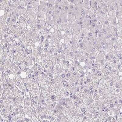 Immunohistochemistry-Paraffin: ATPGD1 Antibody [NBP2-34050]