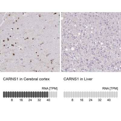 Immunohistochemistry-Paraffin: ATPGD1 Antibody [NBP2-34050]