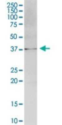 Western Blot: ATPGD1 Antibody [H00057571-B01P]