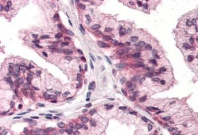 Immunohistochemistry-Paraffin: ATPase Na+/K+ beta 3 Antibody [NBP3-14546]