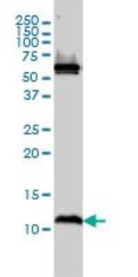 Western Blot: ATPase Inhibitory Factor 1 Antibody (3E2) [H00093974-M01]