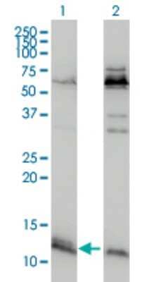 Western Blot: ATPase Inhibitory Factor 1 Antibody (3E2) [H00093974-M01]