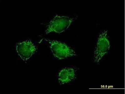 Immunocytochemistry/ Immunofluorescence: ATPase Inhibitory Factor 1 Antibody [H00093974-B01P]