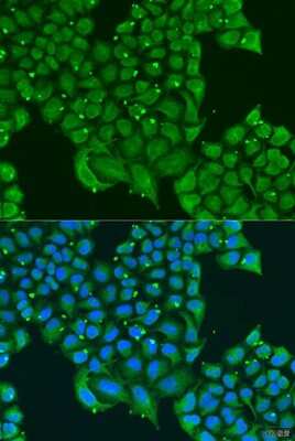 Immunocytochemistry/ Immunofluorescence: ATPase Inhibitory Factor 1 Antibody - BSA Free [NBP2-92891]