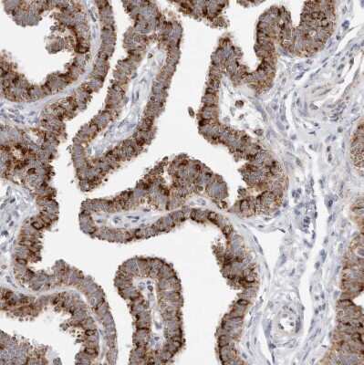 Immunohistochemistry-Paraffin: ATPase Inhibitory Factor 1 Antibody [NBP1-90069]