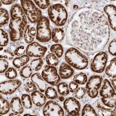 Immunohistochemistry-Paraffin: ATPase Inhibitory Factor 1 Antibody [NBP1-90069]