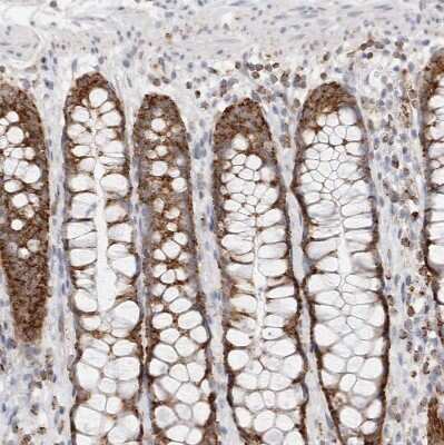 Immunohistochemistry-Paraffin: ATPase Inhibitory Factor 1 Antibody [NBP1-90069]