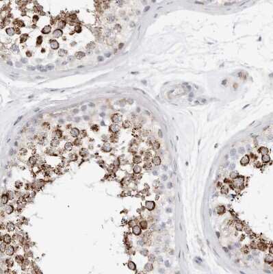 Immunohistochemistry-Paraffin: ATPase Inhibitory Factor 1 Antibody [NBP1-90069]