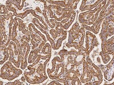 Immunohistochemistry-Paraffin: ATPase Inhibitory Factor 1 Antibody [NBP2-99177]