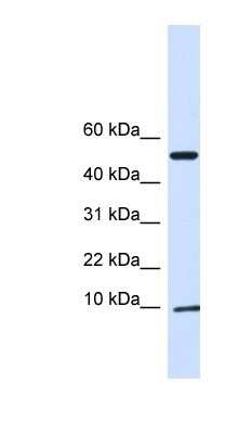 Western Blot: ATPase Inhibitory Factor 1 Antibody [NBP1-79284]