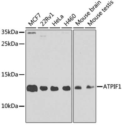 Western Blot: ATPase Inhibitory Factor 1 AntibodyBSA Free [NBP2-92891]