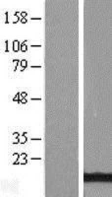 Western Blot: ATPase Inhibitory Factor 1 Overexpression Lysate [NBL1-07852]