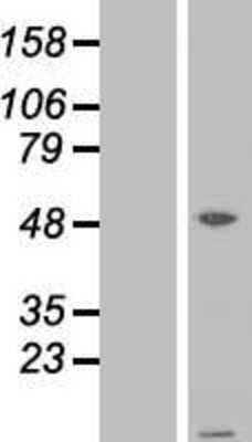 Western Blot: ATPase Inhibitory Factor 1 Overexpression Lysate [NBP2-04992]