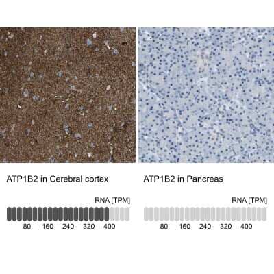 Immunohistochemistry-Paraffin: ATPase Na+/K+ beta 2 Antibody [NBP1-90174]