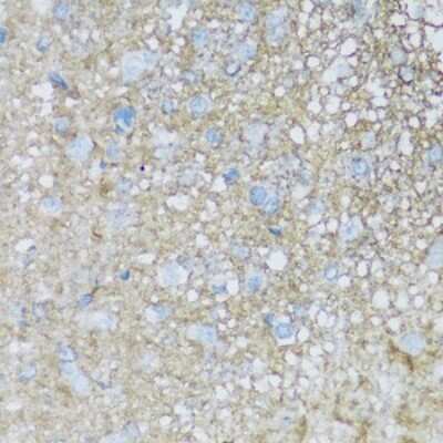 Immunohistochemistry-Paraffin: ATPase Na+/K+ beta 2 Antibody - BSA Free [NBP3-03790]