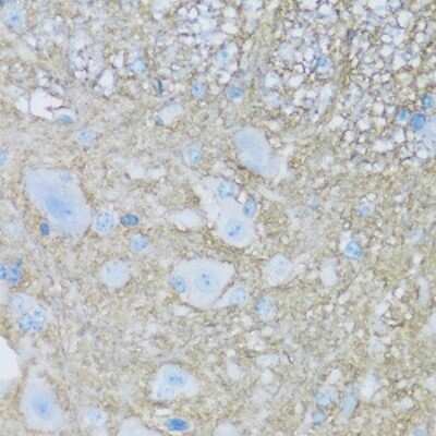 Immunohistochemistry-Paraffin: ATPase Na+/K+ beta 2 Antibody - BSA Free [NBP3-03790]