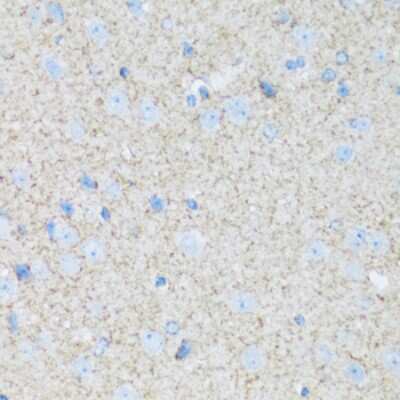 Immunohistochemistry-Paraffin: ATPase Na+/K+ beta 2 Antibody - BSA Free [NBP3-03790]