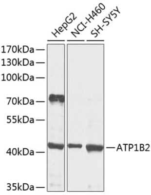 Western Blot: ATPase Na+/K+ beta 2 AntibodyBSA Free [NBP2-92591]