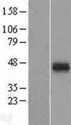 Western Blot: ATPase Na+/K+ beta 2 Overexpression Lysate [NBP2-10893]