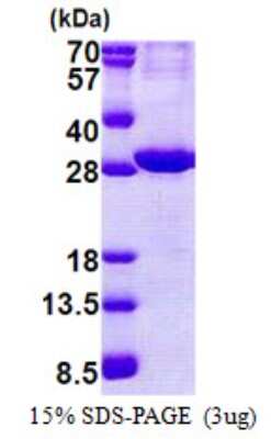 SDS-PAGE: Recombinant Human ATPase Na+/K+ beta 2 His Protein [NBP2-22701]